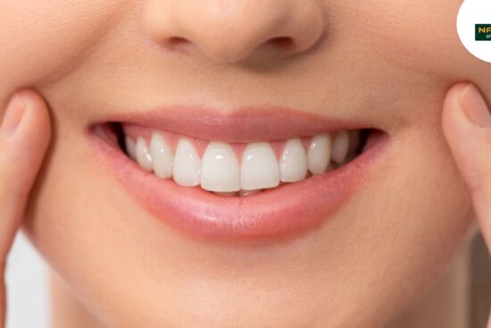 Bright Smile, Clean Plate: How Diet Affects Teeth Whitening