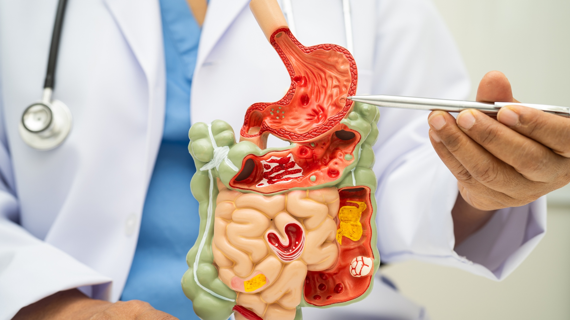 8 ways to improve digestion