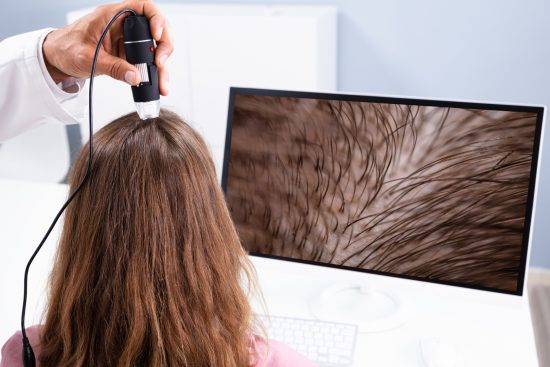 Home remedies to control hair fall