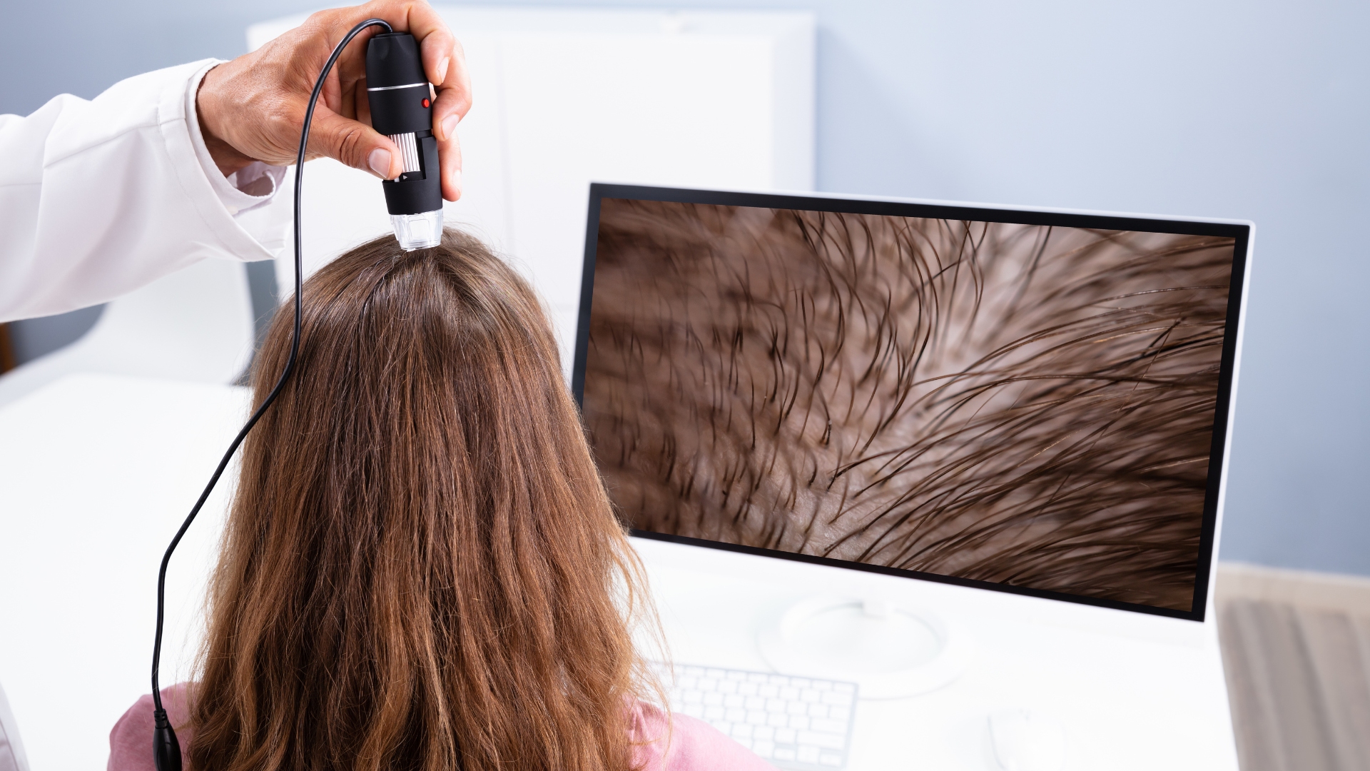 Home remedies to control hair fall