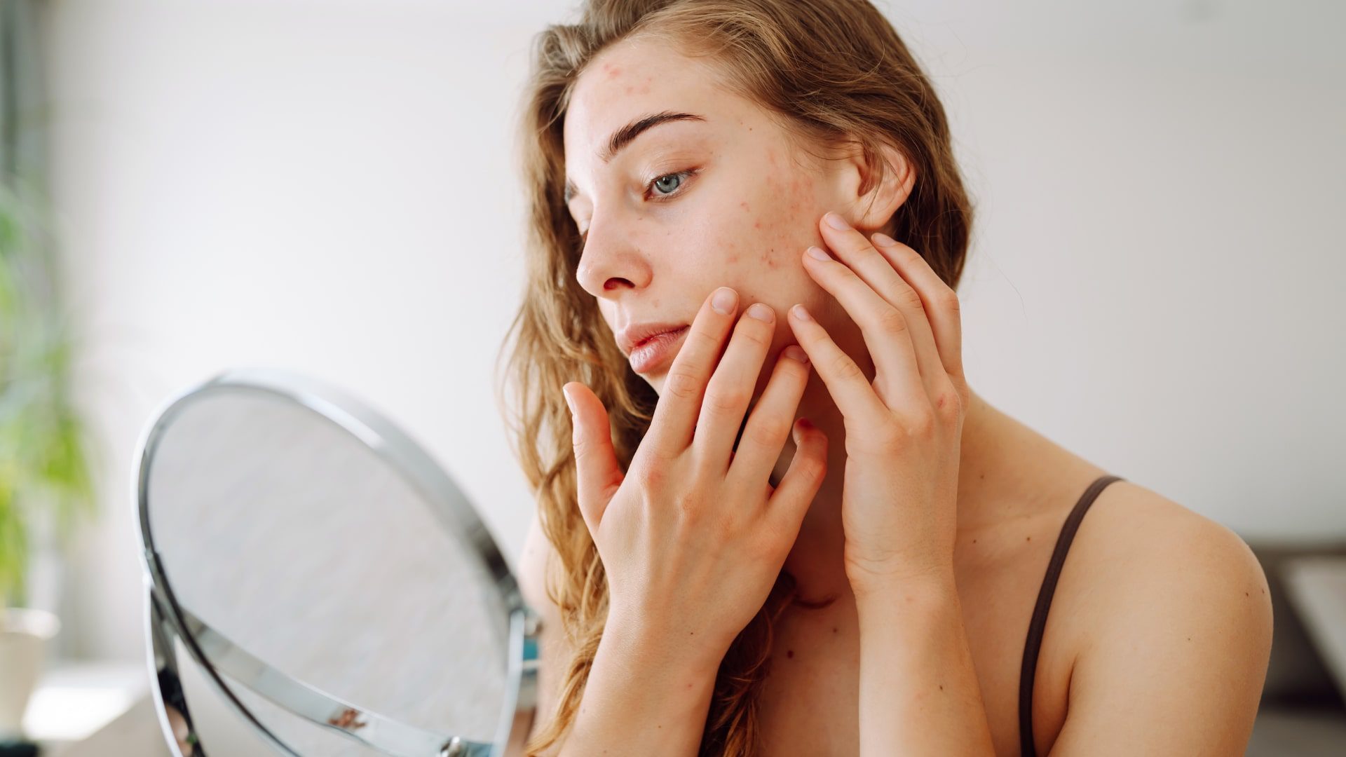 How to Treat Dry Skin Internally-min