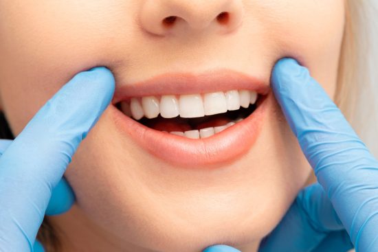 Teeth Whitening Tips How to Get a Brighter Smile Naturally-min