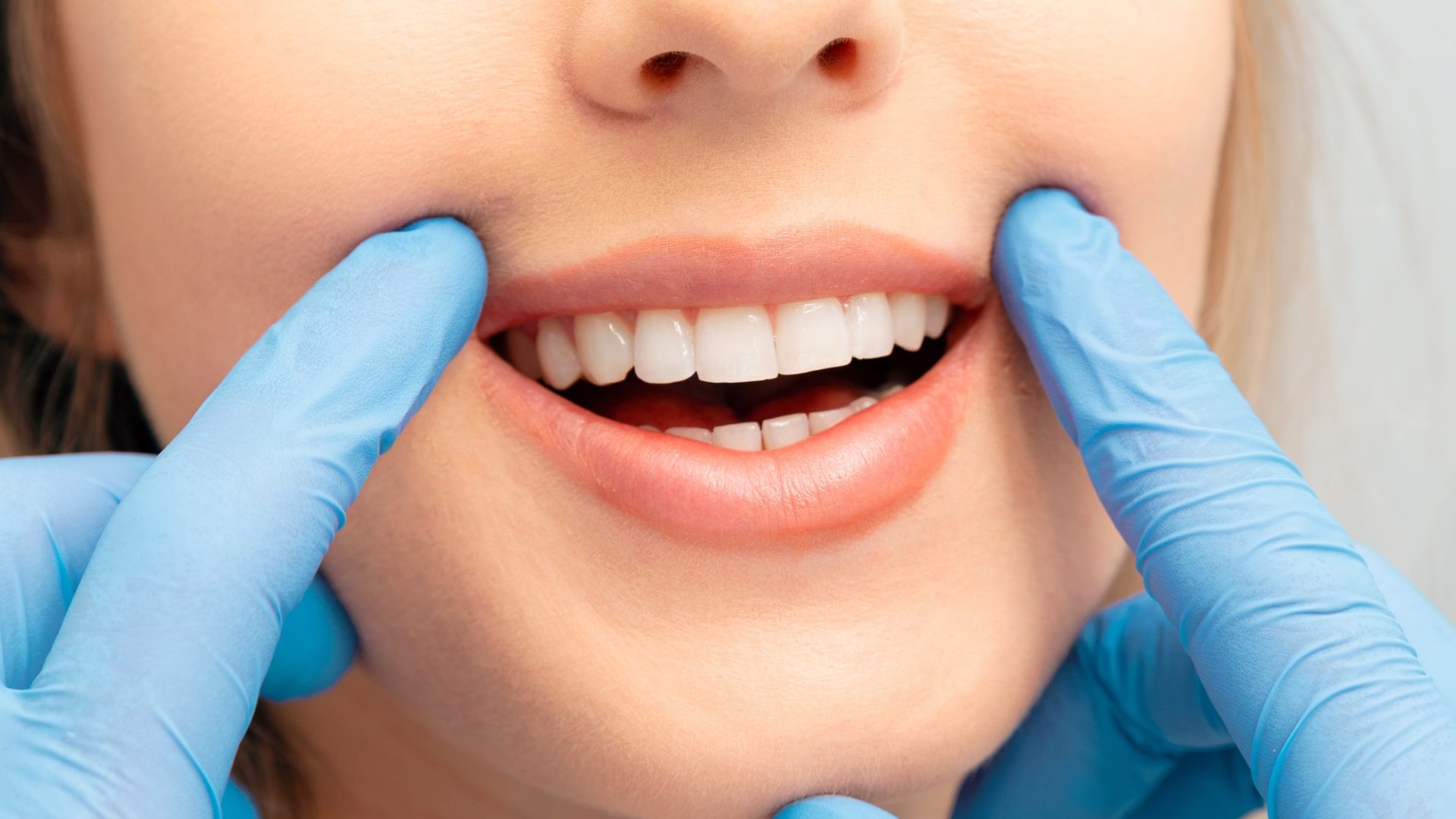 Teeth Whitening Tips How to Get a Brighter Smile Naturally-min
